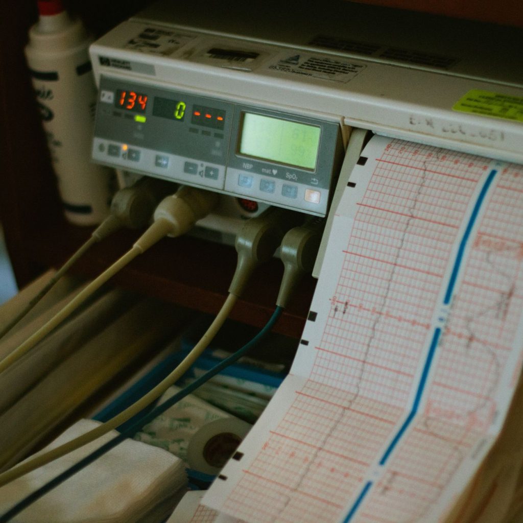 Close-up of an ECG machine displaying heart rate results in a hospital setting. — How can a bum lift benefit my personal situ