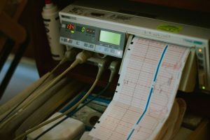 Close-up of an ECG machine displaying heart rate results in a hospital setting. — How can a bum lift benefit my personal situ