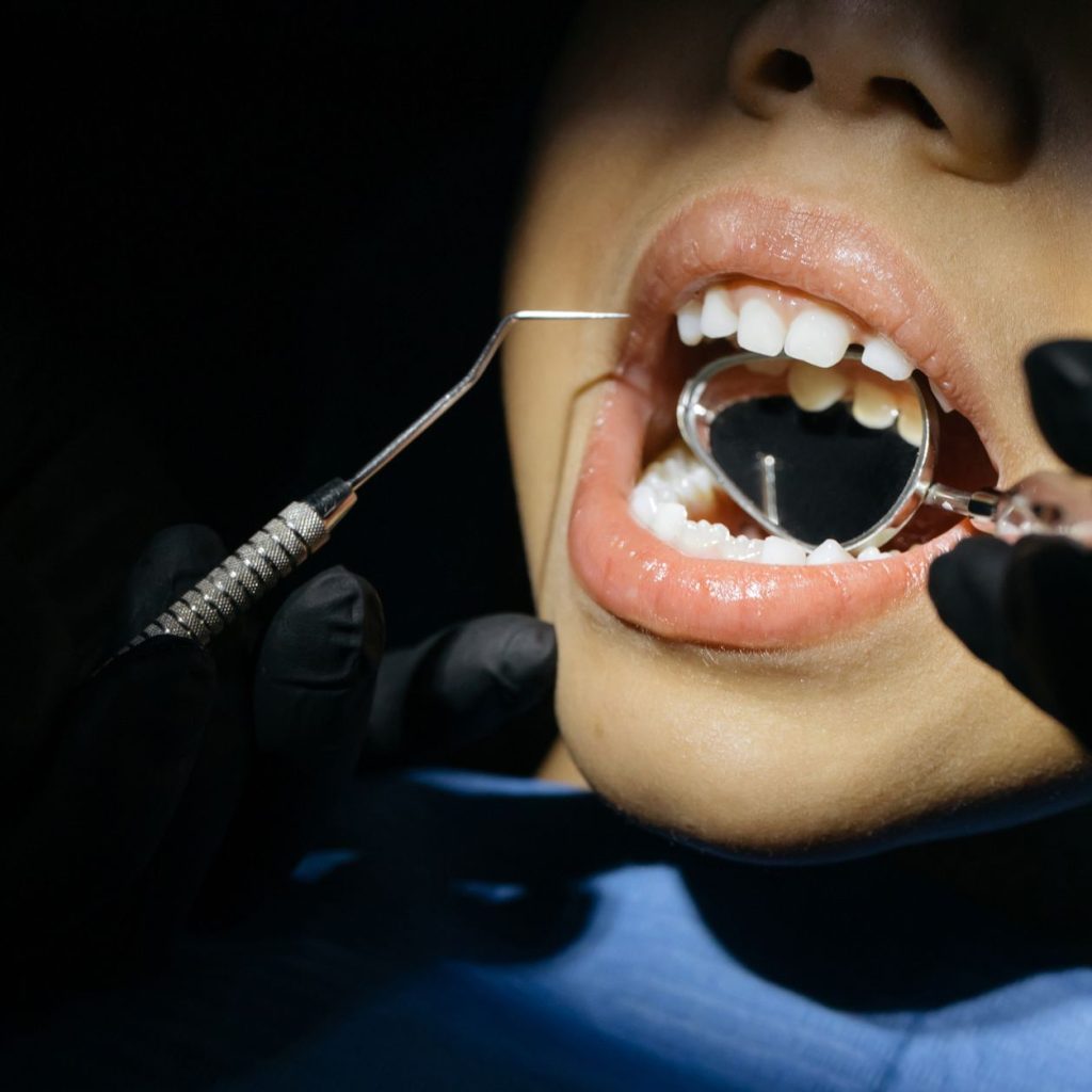 A close-up view of a child undergoing a dental examination with tools in their mouth. — Implant Overdentures: What Are They A