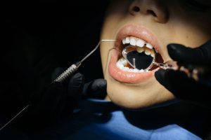A close-up view of a child undergoing a dental examination with tools in their mouth. — Implant Overdentures: What Are They A